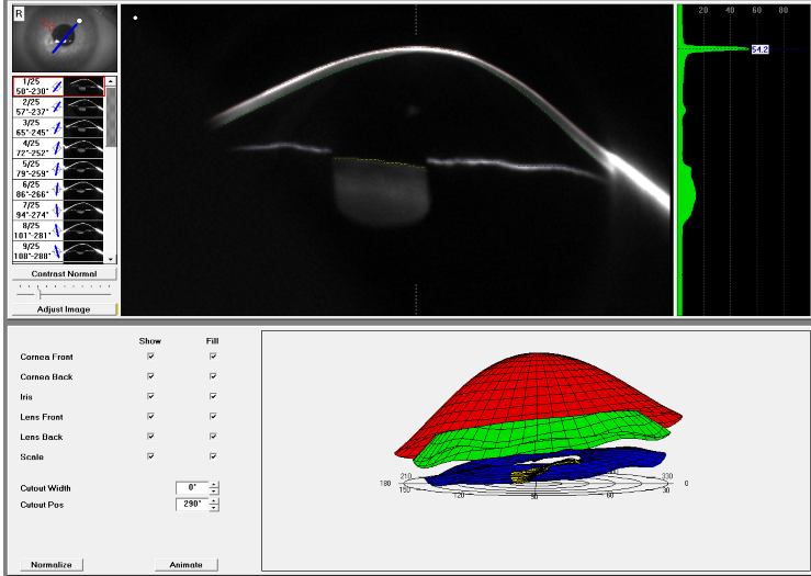 Pentacam 3D Eye Model