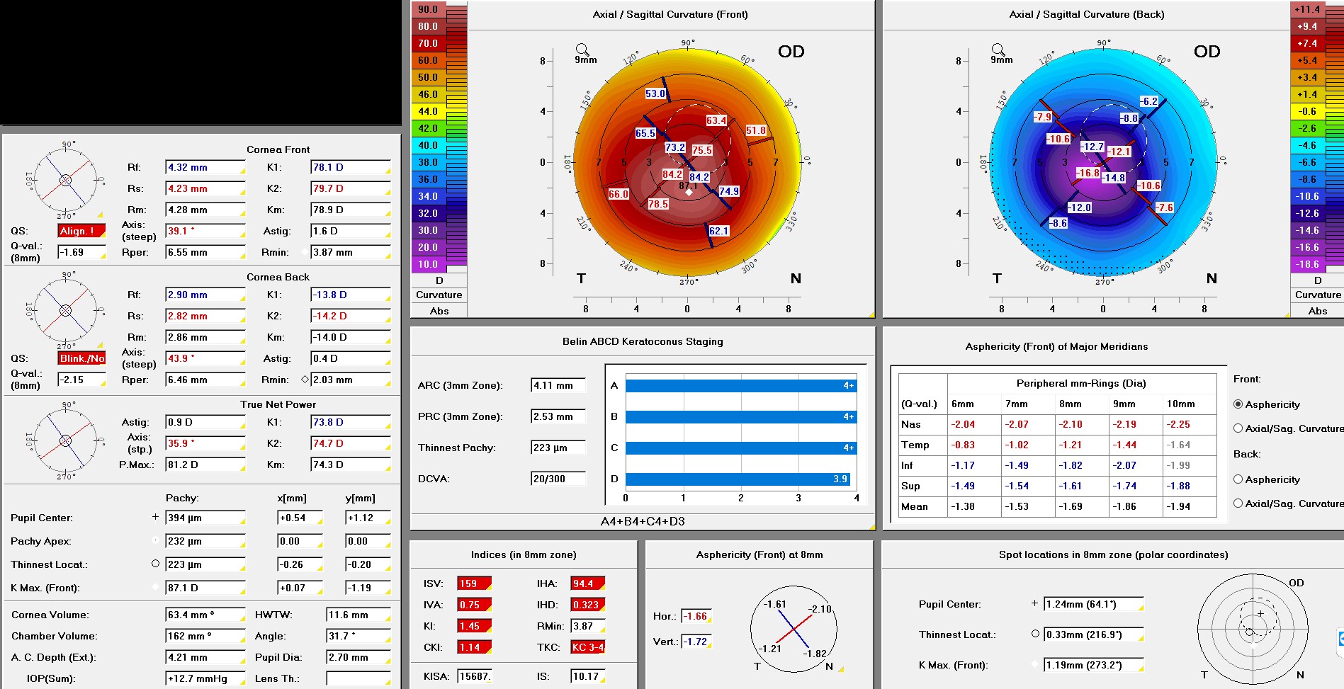 Pentacam Berlin ABCD Keratoconus Staging