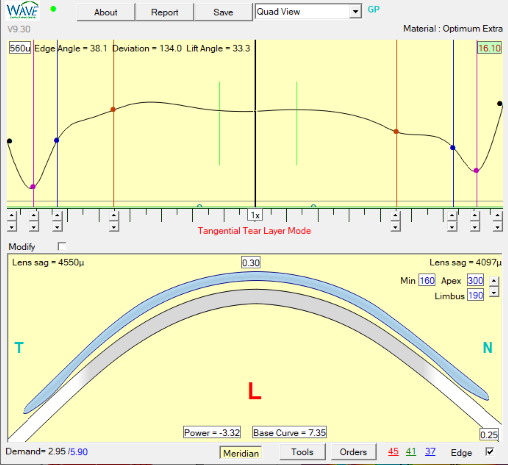 Scleral lens design 2